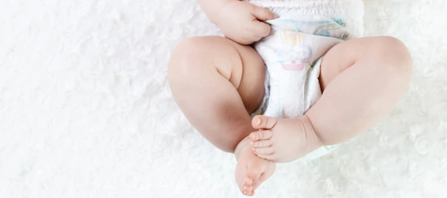 Imagem do post O que é bom para assadura em bebê? Principais tratamentos e como evitar!